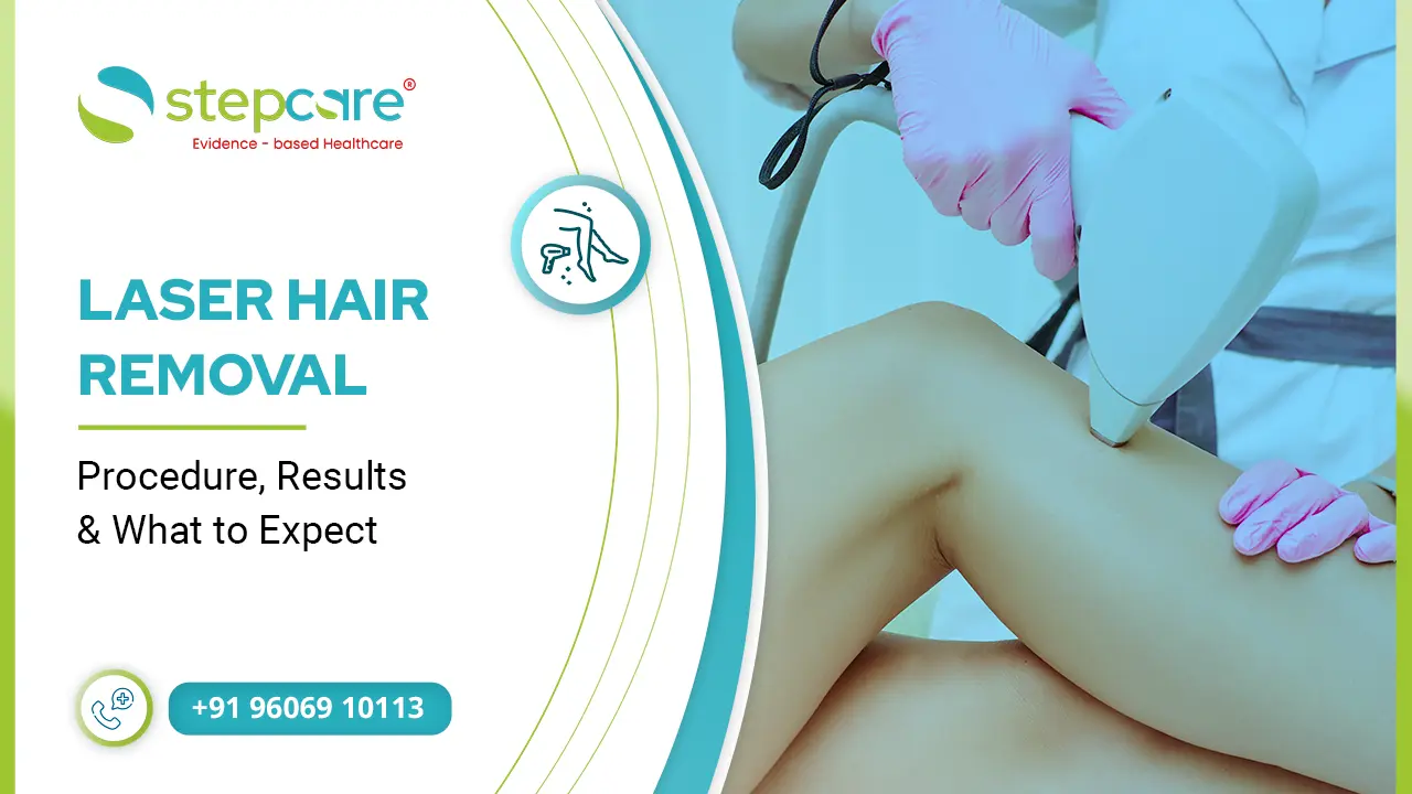 Laser Hair Removal: Procedure, Results & What to Expect