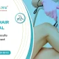 Laser Hair Removal